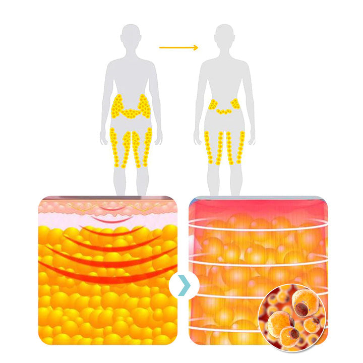 🔥UTÓS NAP - 70% KEDVEZMÉNY)SlimolyTM Matteo ultrahangos testformáló csuklópánt Pro 🔥
