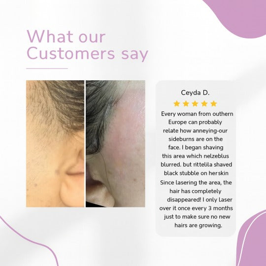 Ylvis IPL szőrtelenítő készülék – Sima, szőrtelen bőr otthon