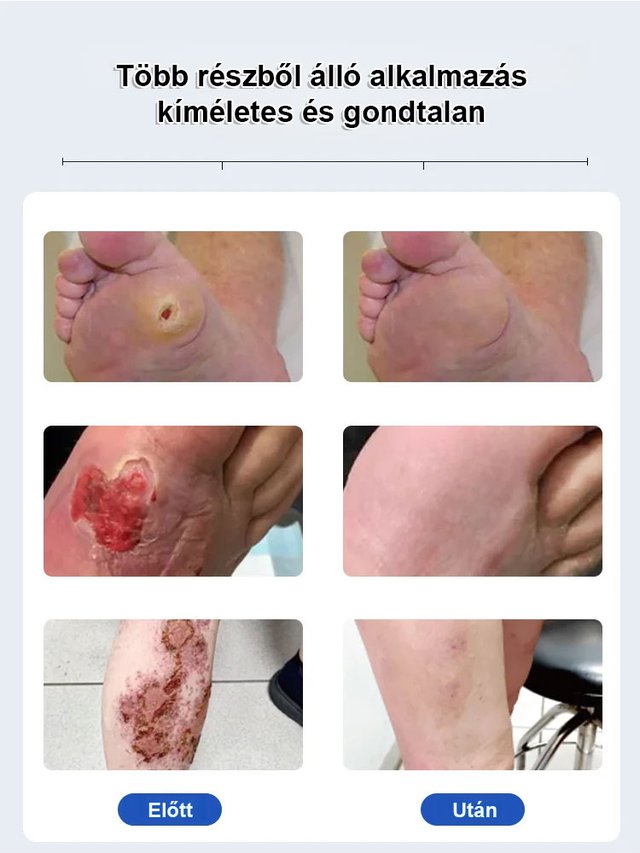 Sumifun vércukorszint kiegyensúlyozó krém