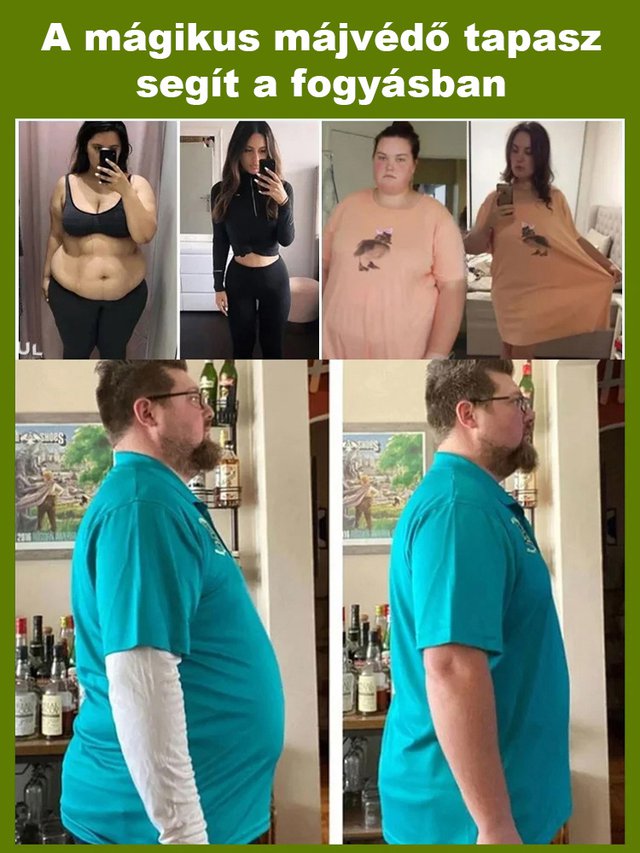 Víz Repülő Thistle kivonat májvédő kapszula