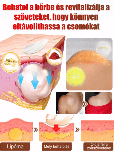 【Egy kenet és nem újul ki】Hét nap alatt eltünteti a lipómákat kenőcs
