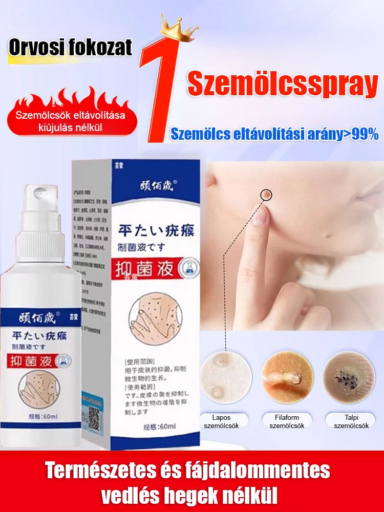 【A szemölcs eltávolítása nem ismétlődik】 Yi Baisui You Monkey antibakteriális folyadék