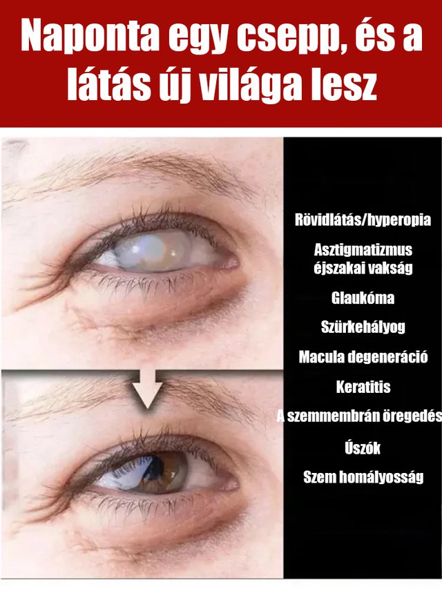 Jimerito mézes szemcsepp