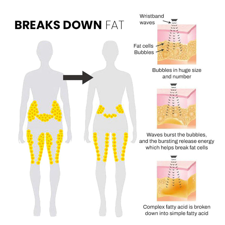 🔥UTÓS NAP - 70% KEDVEZMÉNY)SlimolyTM Matteo ultrahangos testformáló csuklópánt Pro 🔥