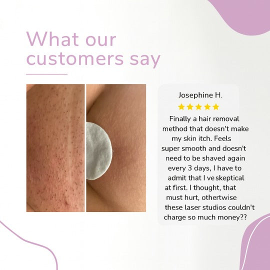 Ylvis IPL szőrtelenítő készülék – Sima, szőrtelen bőr otthon